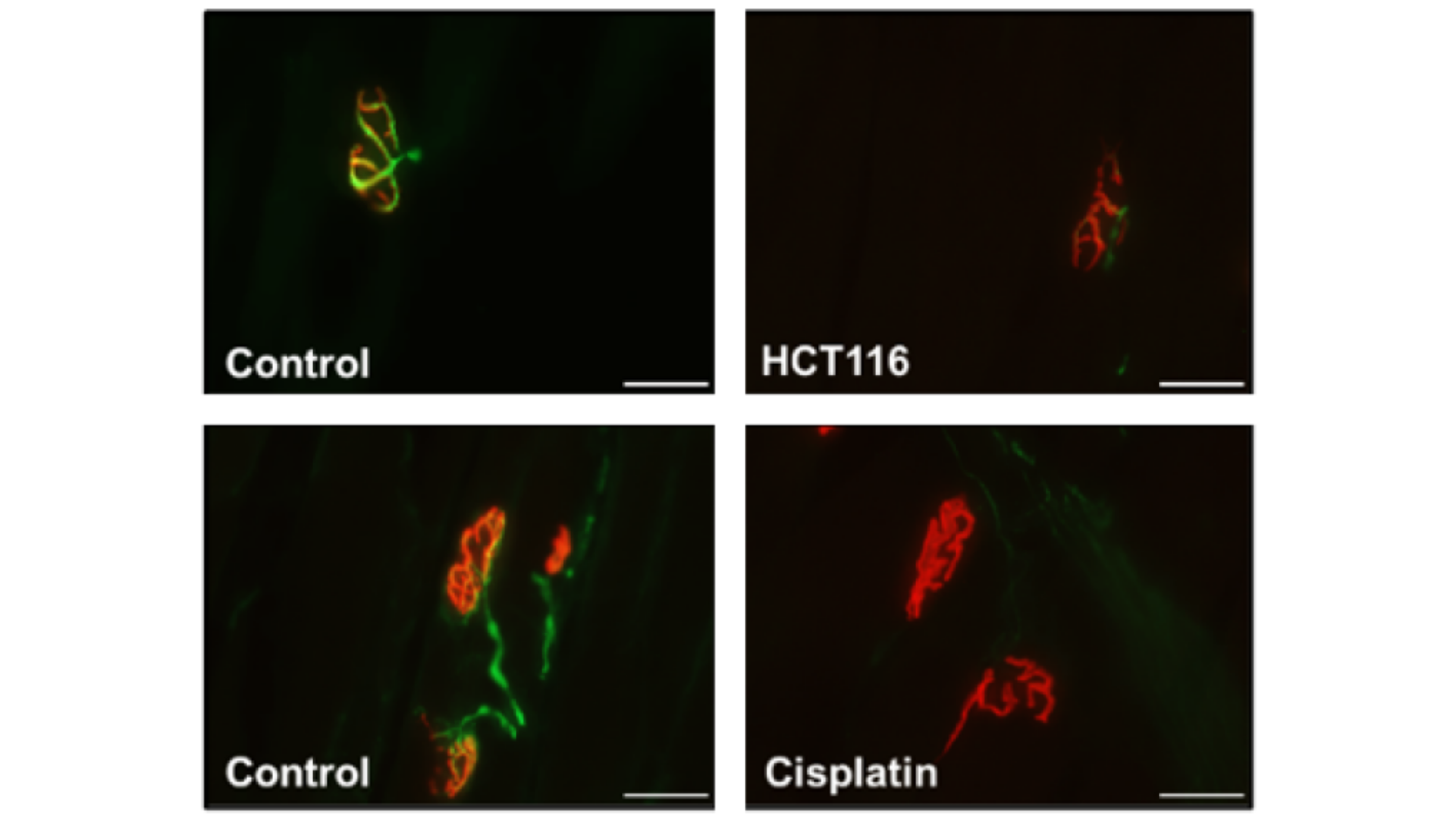 40 × images of SV-2, NF-H and alpha-Bungarotoxin staining of EDL muscles