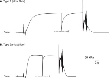 Figure 7 Figure 9. Representative force traces from healthy human vastus lateralis muscle fibers. (A) Type 1 fiber (B) Type 2a fiber. (Roche et al. JoVE (https://www.jove.com/t/52695/measurement-maximum-isometric-force-generated-permeabilized-skeletal) 2015).