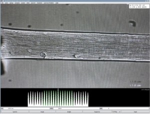 Figure 9 Figure 9. Single muscle fiber sarcomere striations shown in 901D HVSL.