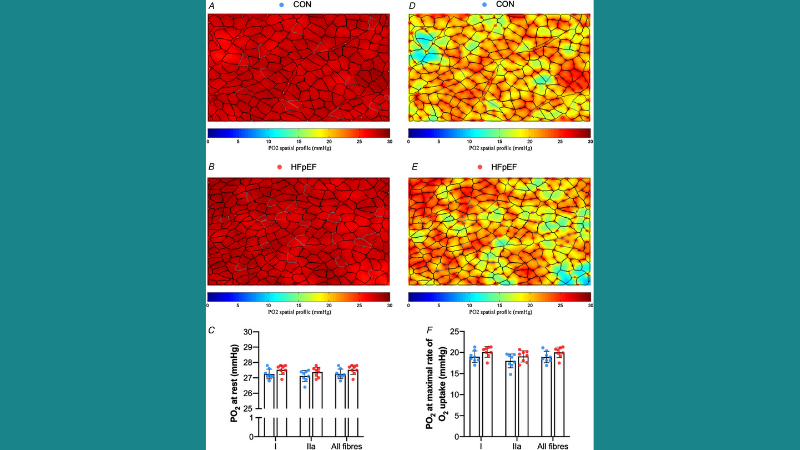 Modelling of soleus muscle oxygen tension image from Espino-Gonzalez et al 2021