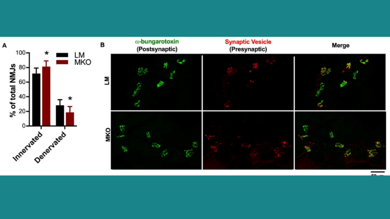 Featured image demonstrates that neuromuscular junction (NMJ) integrity changes with a lifelong Ulk1 deficiency (© 2021 Nichenko, A. S. et al.).