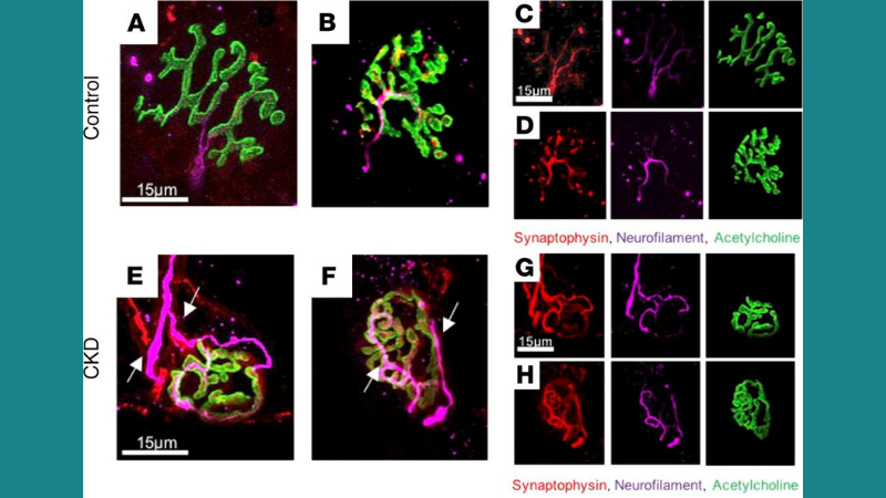 Mitochondrial Bioenergetics and Muscle Function