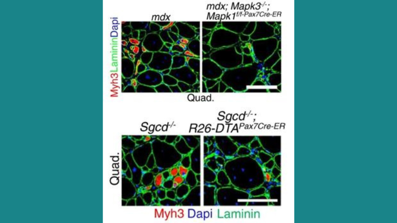 Attenuating Muscle Disease Pathology