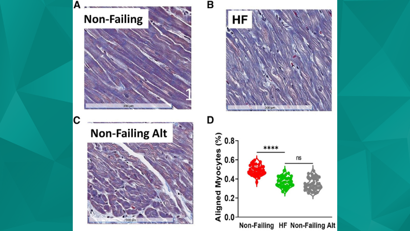 Analyzing Cardiac Tissue Function