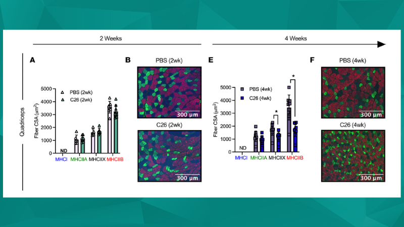 Cancer Cachexia-Induced Muscle Atrophy