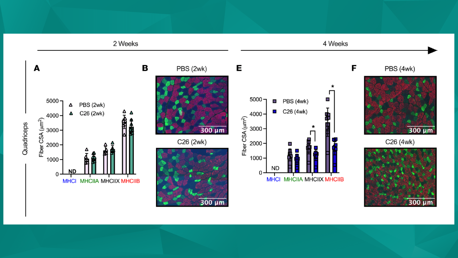 Cancer Cachexia-Induced Muscle Atrophy Cancer Cachexia-Induced Muscle Atrophy